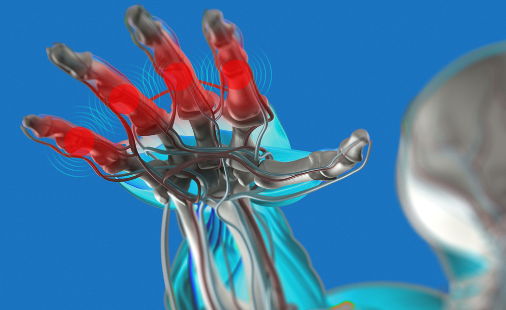 artrite: come trattarla con la crioterapia