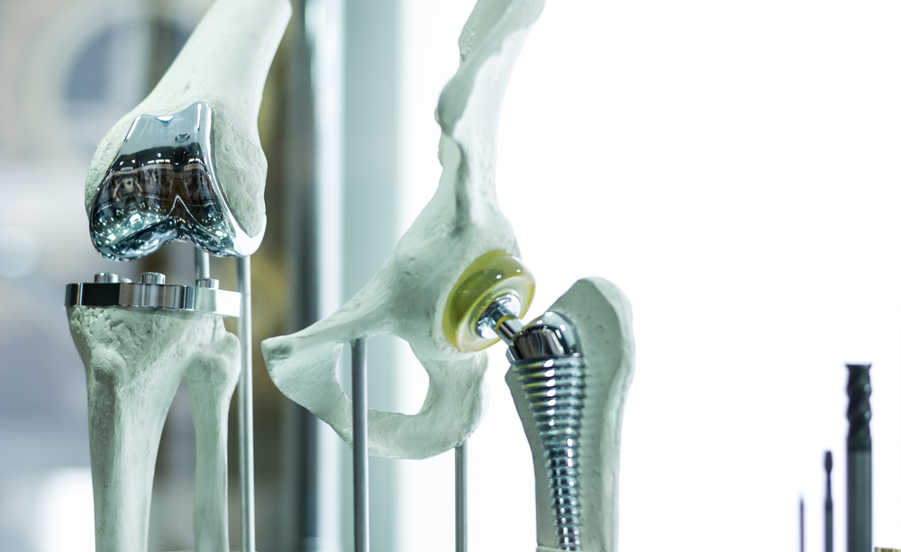 protesi: le nuove frontiere in campo protesico