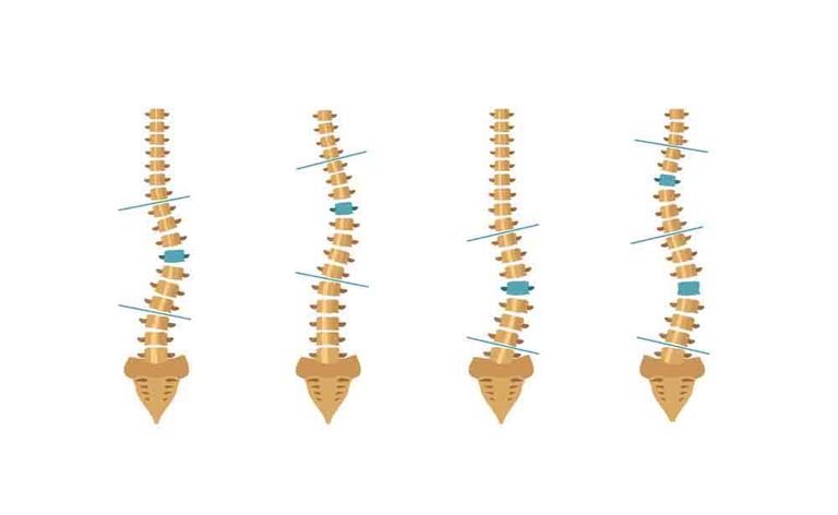 dimorfismi e paramorfismi: come fare a prevenirli