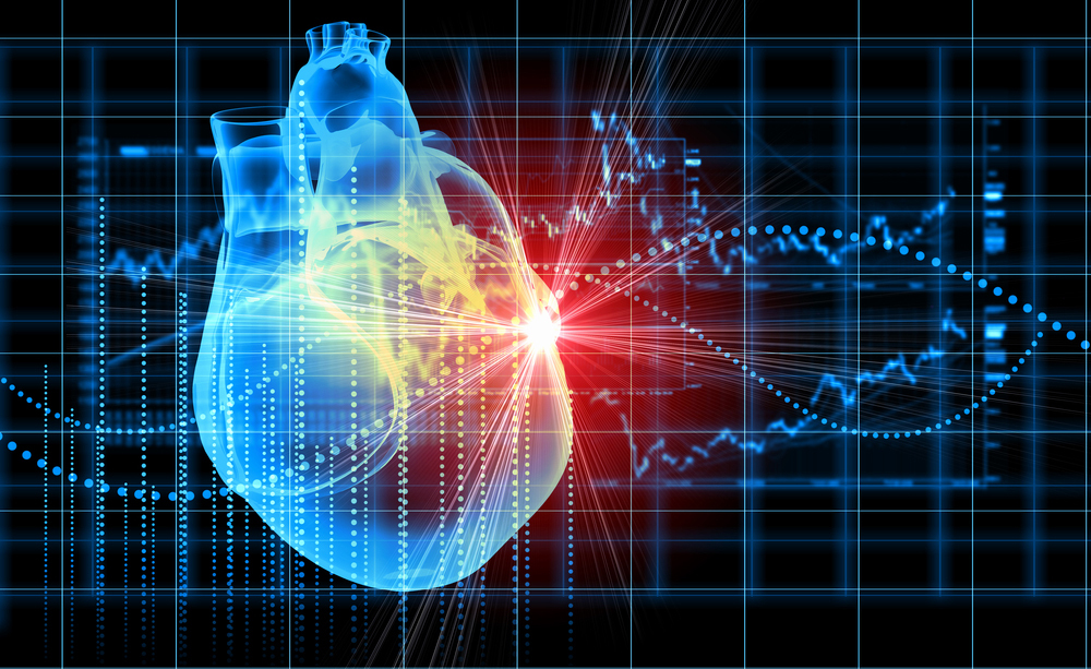 cardiochirurgia: le tecniche mininvasive