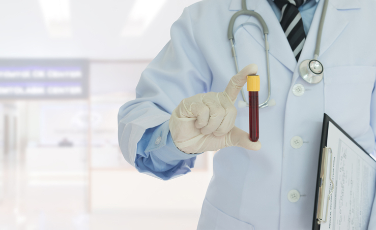 hiv: i sintomi della malattia virale