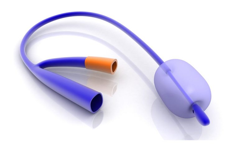 catetere vescicale: quando si utilizza