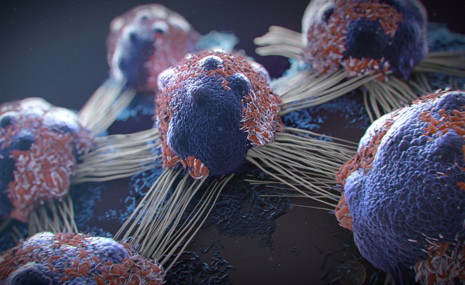 termoablazione percutanea per combattere il cancro