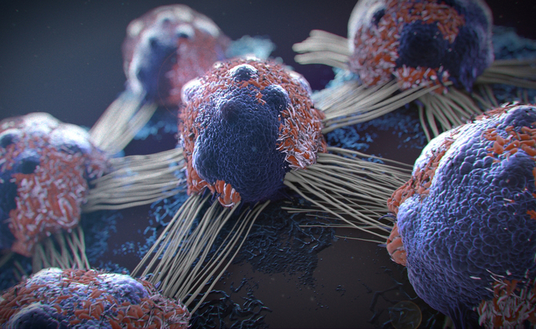 termoablazione percutanea per combattere il cancro