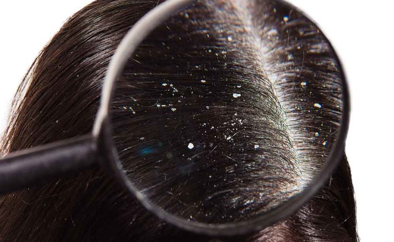 forfora: è contagiosa?