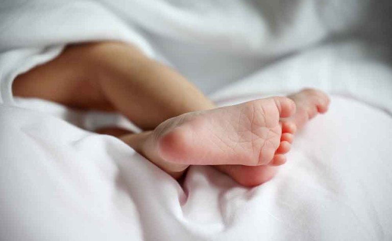 piede torto: come curare il disturbo con la fisioterapia