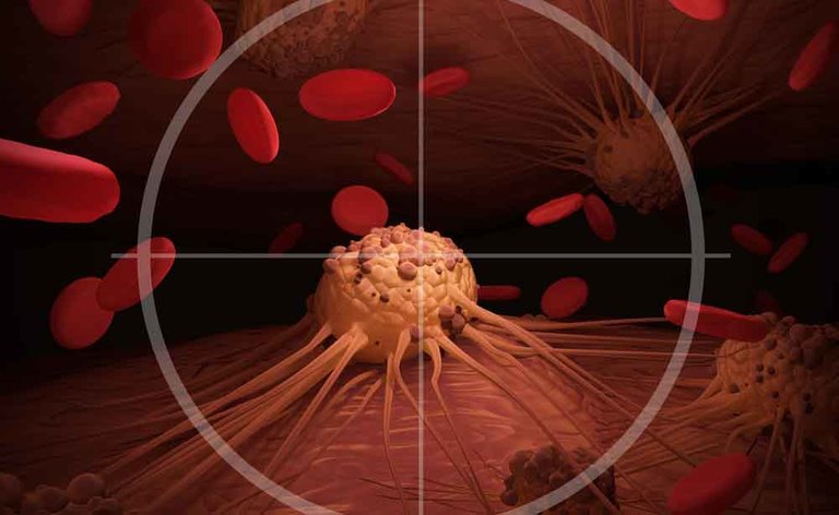 linfoma: la diagnosi con i raggi X