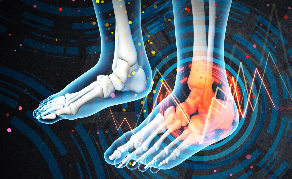 Piede diabetico: quando l'amputazione è necessaria