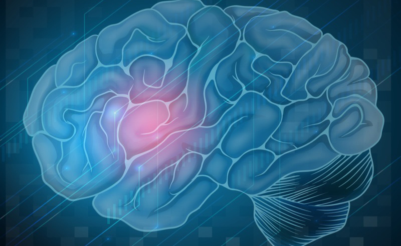 ictus: cosa fare per prevenirlo