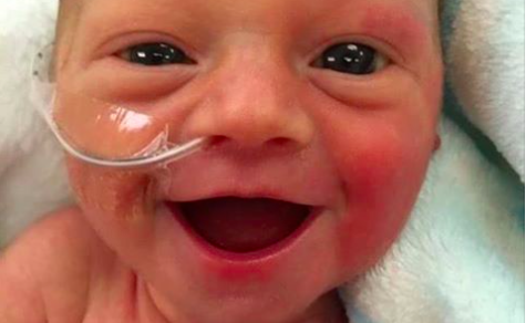 I casi di nascite premature in Italia; cosa è bene fare in questi casi