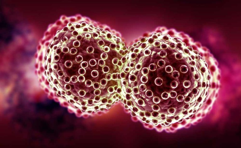 Tumore al seno: i rischi della pillola anticoncezionale