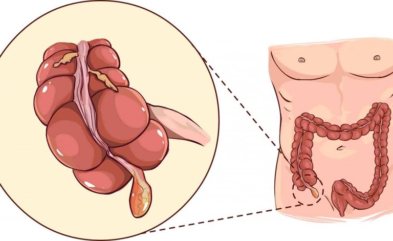 Appendice: 9 cose da sapere