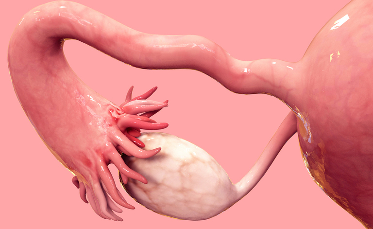 Tumore alle ovaie: i test del DNA per la prevenzione