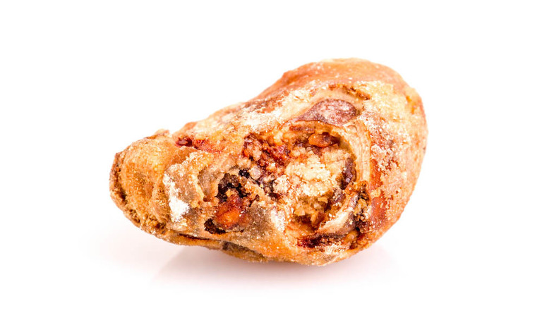 Calcoli salivari: cosa sono e come rimuoverli