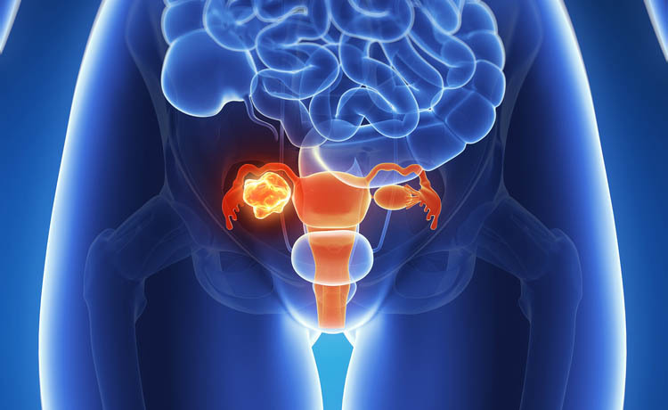 Dolore vaginale: le cause