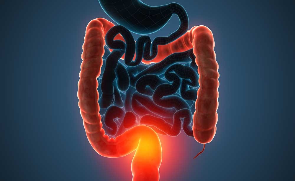 Morbo di Crohn: lo studio