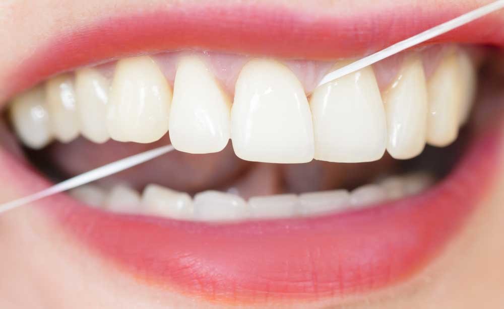 Filo interdentale: igiene orale