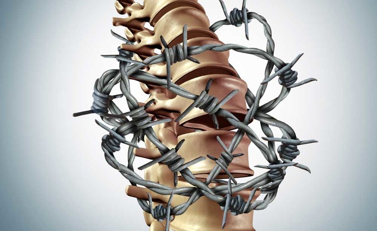 Fibromialgia: la cura con la crioterapia