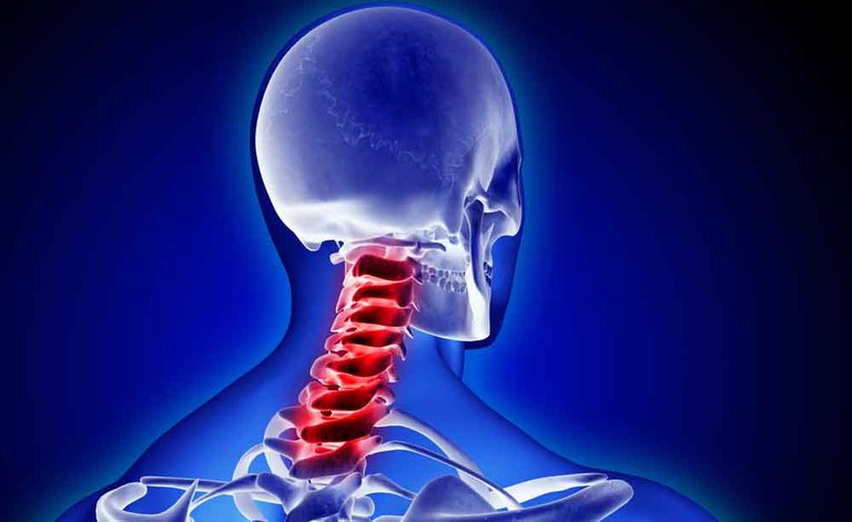 Dolore cervicale: le cause, i sintomi