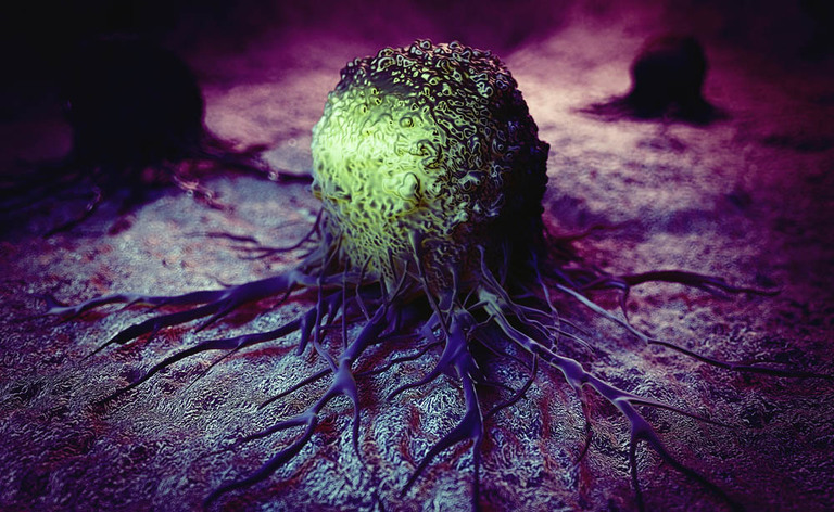 Cancro: i tipi di tumore più comuni negli uomini e nelle donne