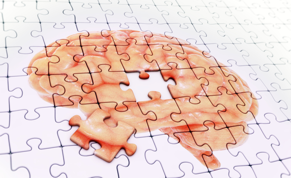 Morbo di Alzheimer: come prevenirlo