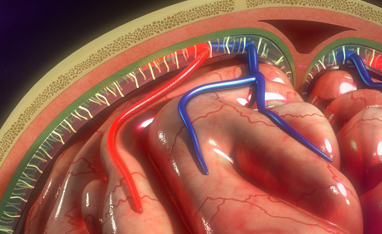 prevnire-meningite-vaccino-pneumococco-c