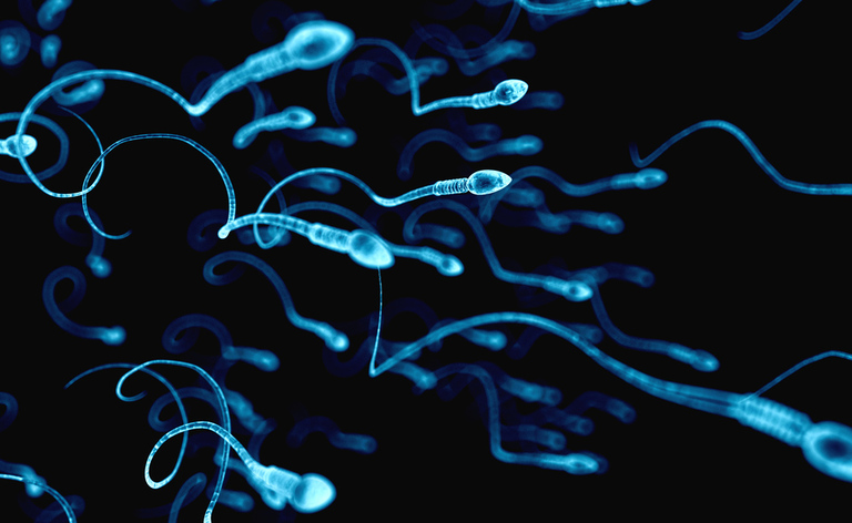 Infertilità maschile: le cause del disturbo