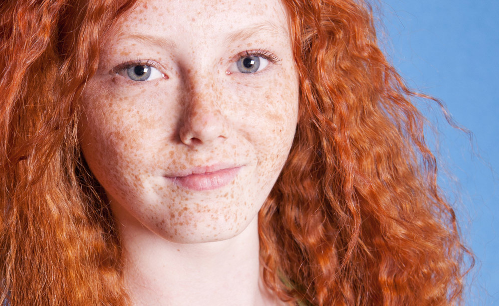 gene ginger: cancro alla pelle