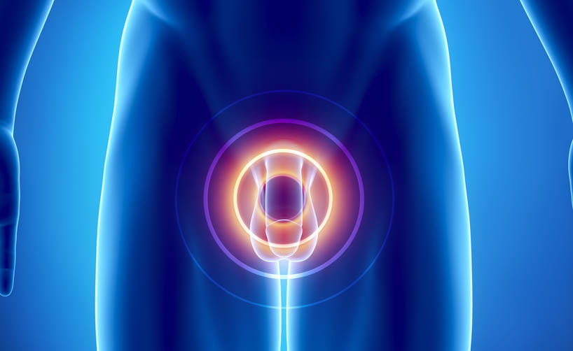 Le cause della Frattura del pene