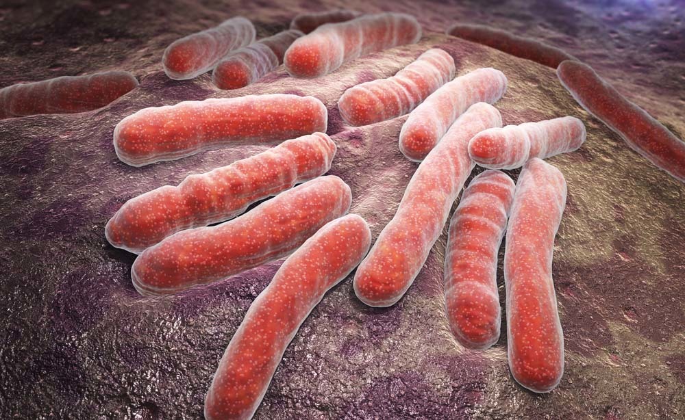 Tubercolosi e diagnosi