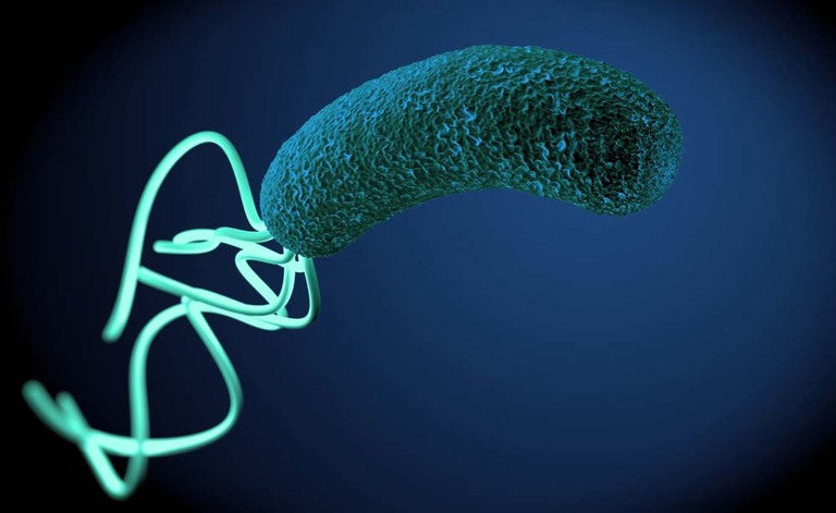 Helicobacter pylori: come si cura