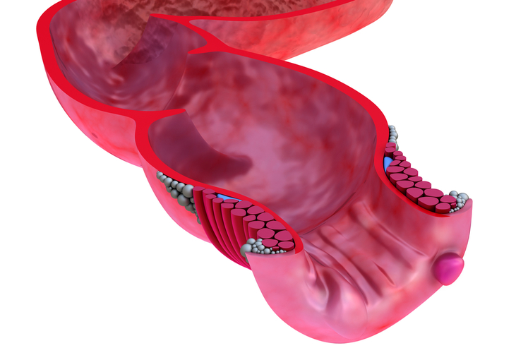 emorroidi: cause e rimedi