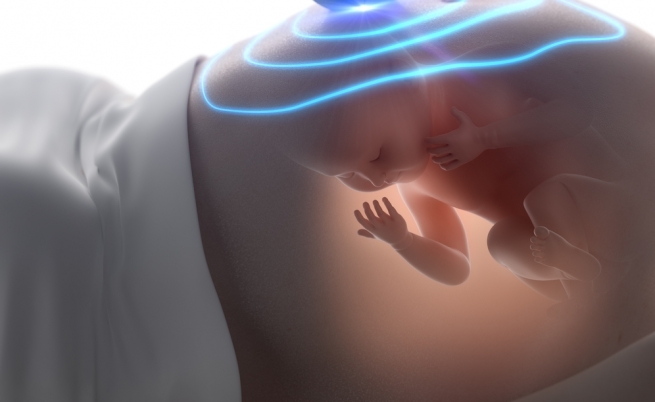 Sindrome di Down: come diagnosticarla in gravidanza