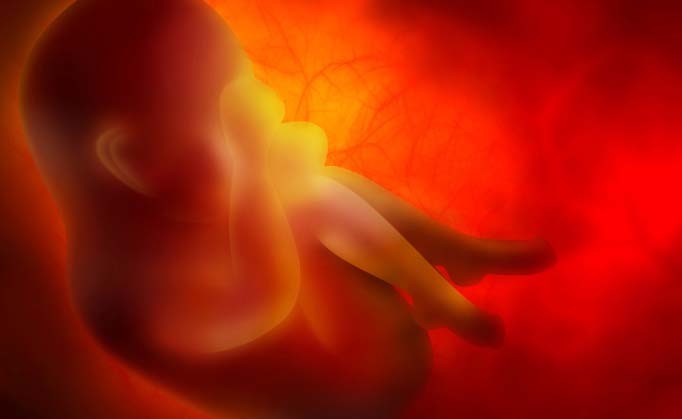 Sindrome di Down: le cause e la diagnosi