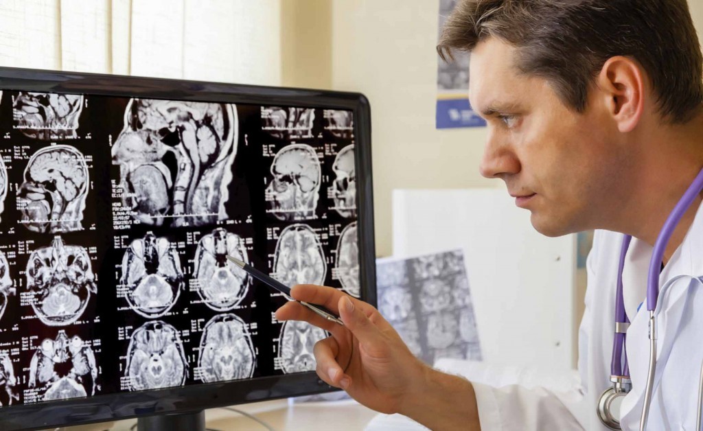 Cosa Succede Se Usiamo Il 100 Del Cervello