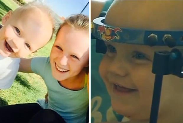 Frattura della prima e della seconda vertebra in un ...