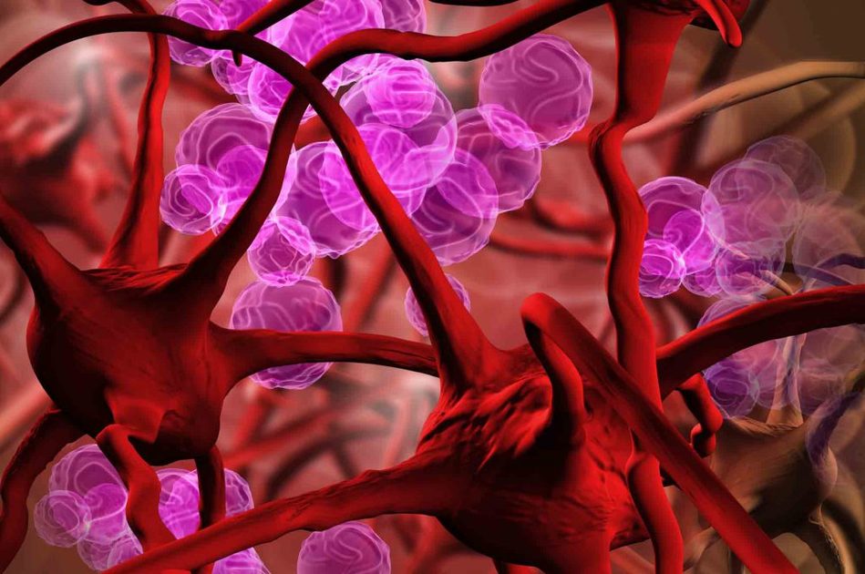 anemia mediterranea: Sintomi e Diagnosi