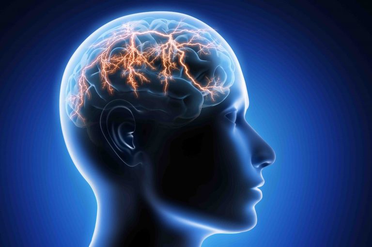 Epilessia: i Sintomi e la Diagnosi