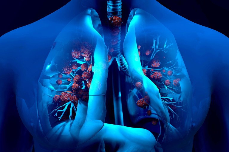 Coronavirus in Lombardia: tutti i dettagli