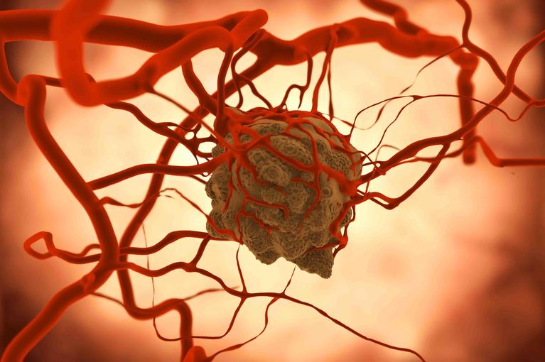 Tumore e alimentazione