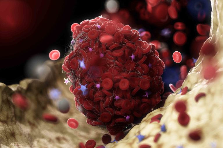 Trombo e Coronavirus