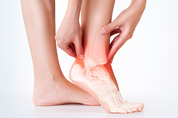 Artrite reumatoide ai piedi: i sintomi e come alleviare il dolore