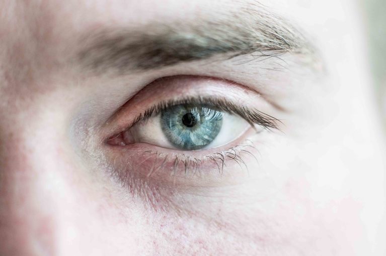 Cecità: cause