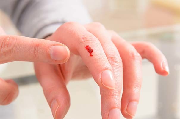 Come fermare il sangue di una ferita