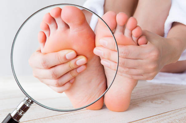 Le cause dei piedi rossi