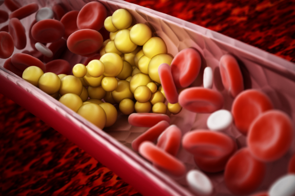 Colesterolo nel sangue