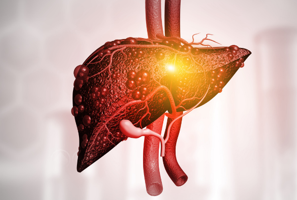 Primo Piano di un Fegato Poco Sano