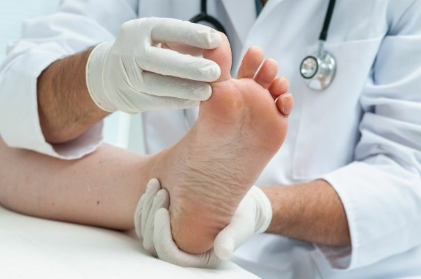 Unghia Nera sul Piede di uno Sportivo in Cura dal Medico