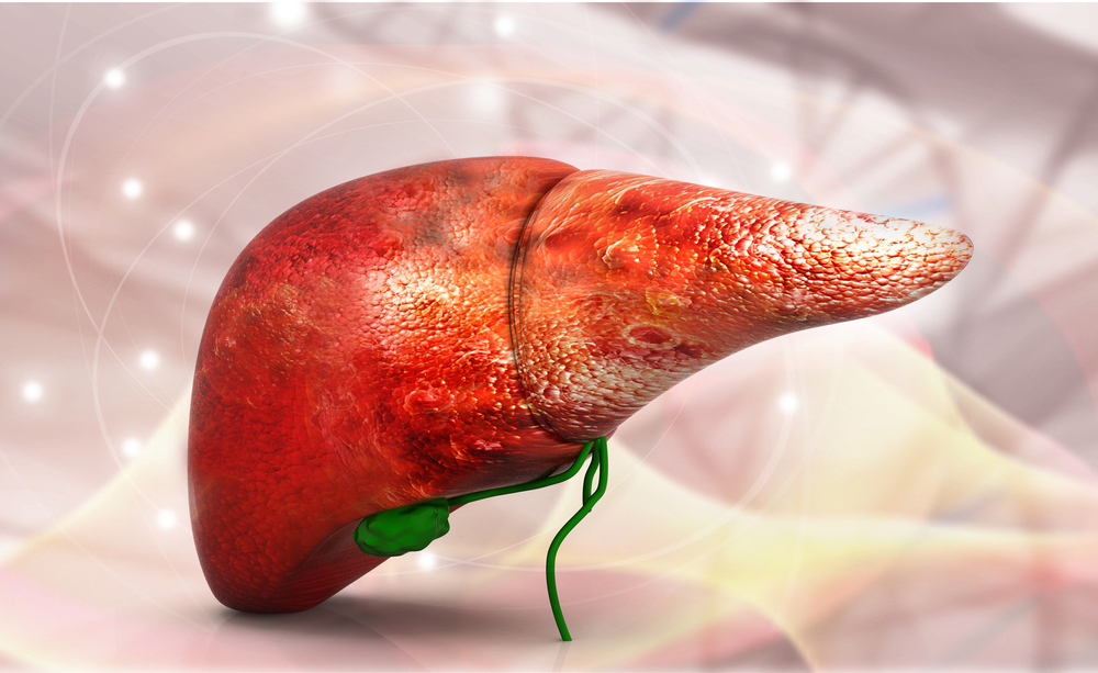 Calcoli Biliari: Regole Alimentari per Prevenirli e Mantenere Sano il Fegato