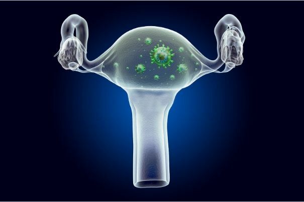 Papilloma Virus intorno a un Utero